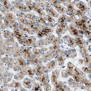 BAAT Antibody - BSA Free