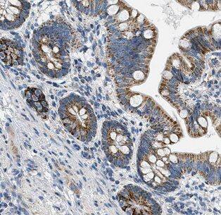 B4GALT6 Antibody - BSA Free