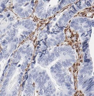 beta-1,4-Galactosyltransferase 2/B4GalT2 Antibody - BSA Free