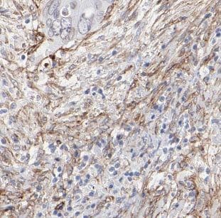 B4GALNT2 Antibody - BSA Free