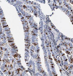 B3GNT7 Antibody - BSA Free