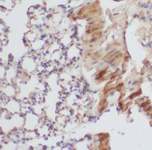 B3GNT5 Antibody - BSA Free