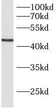B3GNT5 Antibody - BSA Free