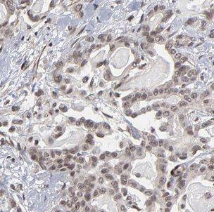 B3GALT4 Antibody - BSA Free