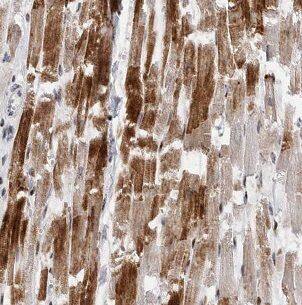 B3GALT2 Antibody - BSA Free