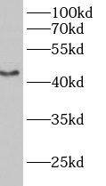 B3GALT2 Antibody - BSA Free