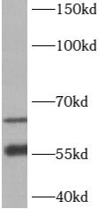 B3GALNT2 Antibody - BSA Free
