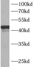 B3GALNT1 Antibody - BSA Free