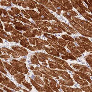 B3GALNT1 Antibody - BSA Free