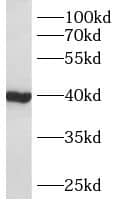 AWAT2 Antibody - BSA Free