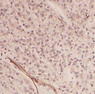 Ancient ubiquitous protein 1 Antibody - BSA Free