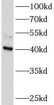 ATXN3L Antibody - BSA Free