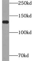 Ataxin-2-like protein Antibody - BSA Free