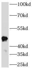 ATPBD4 Antibody - BSA Free