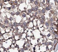 ATP9A Antibody - BSA Free