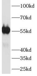 ATP6V1B1 Antibody - BSA Free