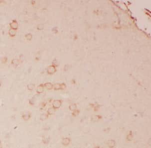 ATPase Na+/K+ beta 2 Antibody - BSA Free