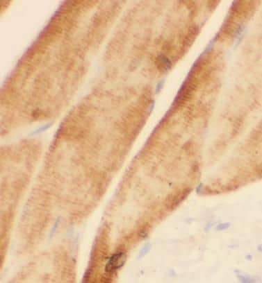 Sodium Potassium ATPase Alpha 2 Antibody - BSA Free