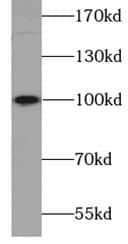 Sodium Potassium ATPase Alpha 2 Antibody - BSA Free