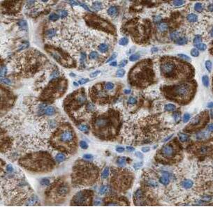 ATP11B Antibody - BSA Free