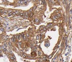 ATG2B Antibody - BSA Free