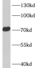 ACCN4 Antibody - BSA Free