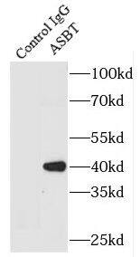 SLC10A2 Antibody - BSA Free