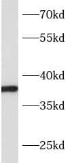 SLC10A2 Antibody - BSA Free