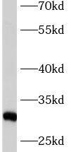 ASB9 Antibody - BSA Free