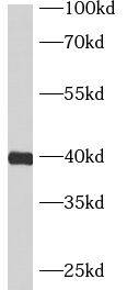 ASB5 Antibody - BSA Free