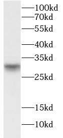 ASB13 Antibody - BSA Free