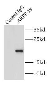 ARPP19 Antibody - BSA Free