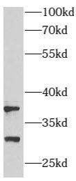 ARMC10 Antibody - BSA Free