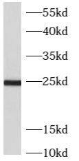 ARL5B Antibody - BSA Free