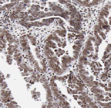 ARL2 Antibody - BSA Free