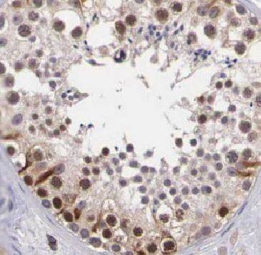 BRCAA1 Antibody - BSA Free