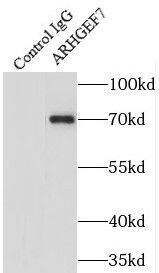 ARHGEF7 Antibody - BSA Free