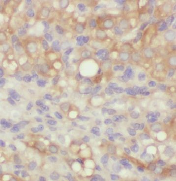 ARHGAP21 Antibody - BSA Free