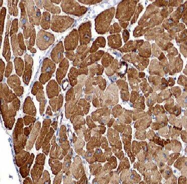 ARHGAP10 Antibody - BSA Free