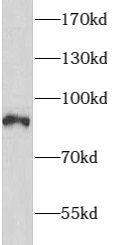 ARHGAP10 Antibody - BSA Free