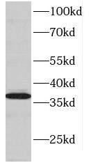 DNTTIP1 Antibody - BSA Free