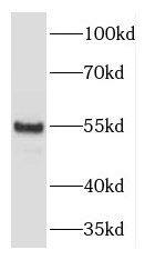 Aspartyl Aminopeptidase Antibody - BSA Free