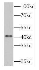 DNASE2B Antibody - BSA Free