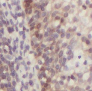 DNASE2B Antibody - BSA Free