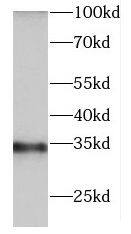 DNASE1L3 Antibody - BSA Free
