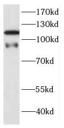 DNAJC6 Antibody - BSA Free