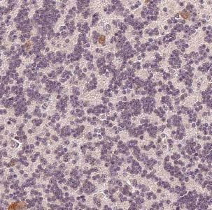 DNAJC6 Antibody - BSA Free