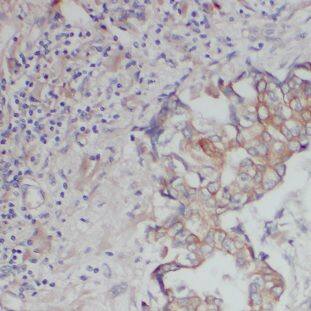 DNAJC4 Antibody - BSA Free