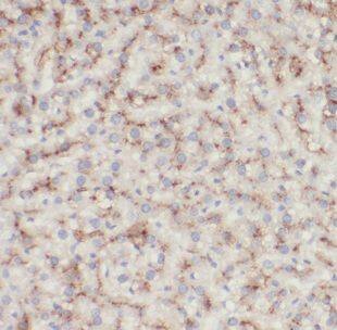 DNAJC15 Antibody - BSA Free