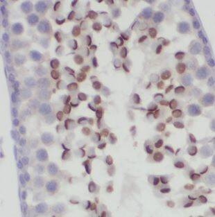 DNAJB13 Antibody - BSA Free